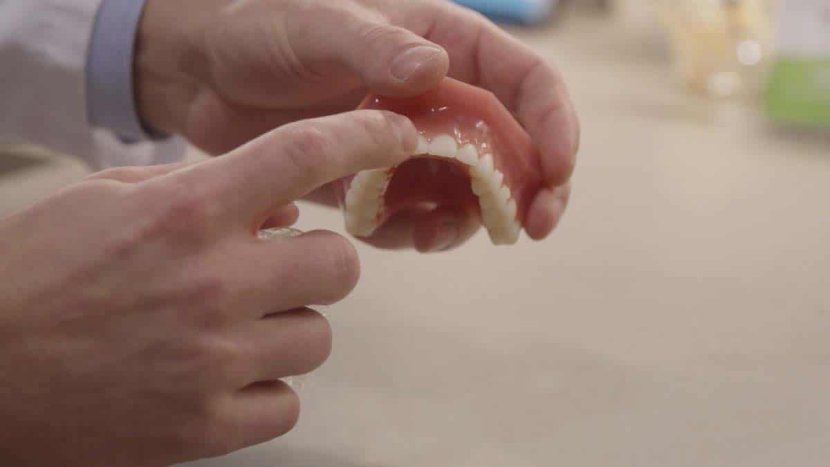 Custom Oral Appliances