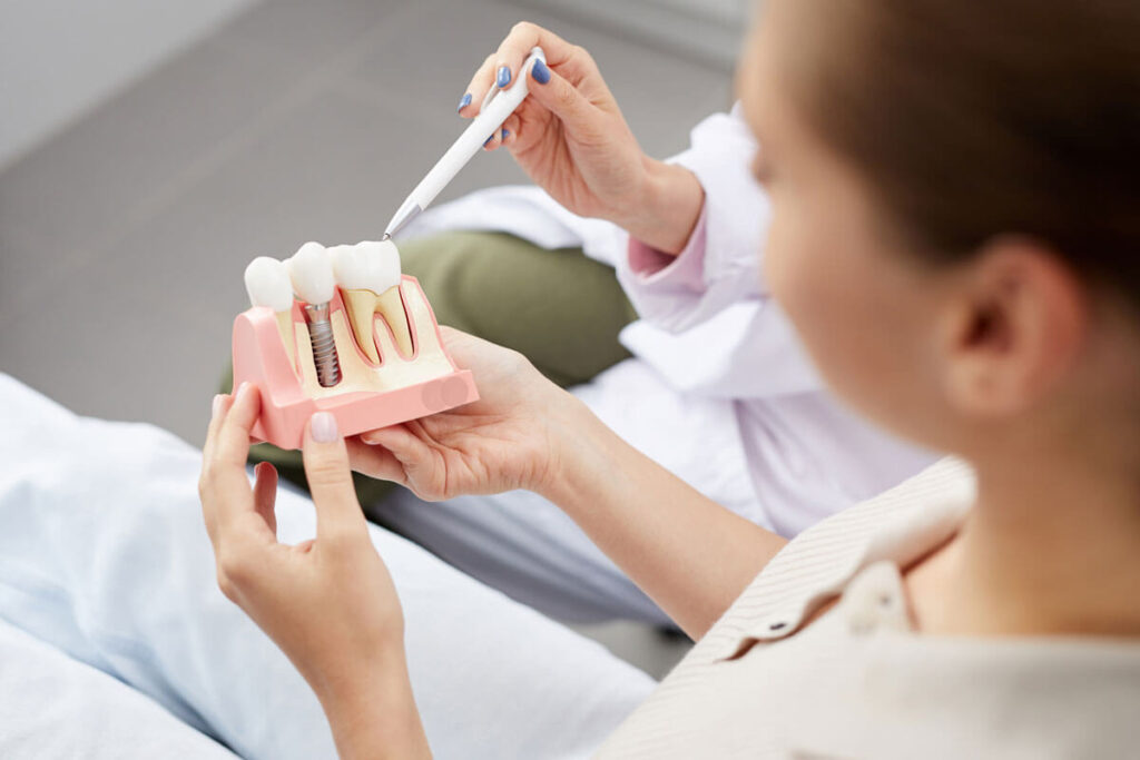Top Signs You May Need a Dental Impla