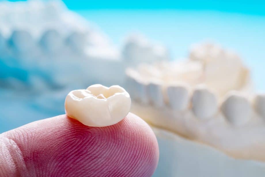 How Much Tooth Structure Is Needed For A Crown?